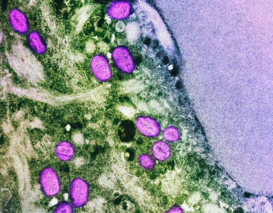 PH's 1st mpox case this year, traced back to spa, derma clinic in QC