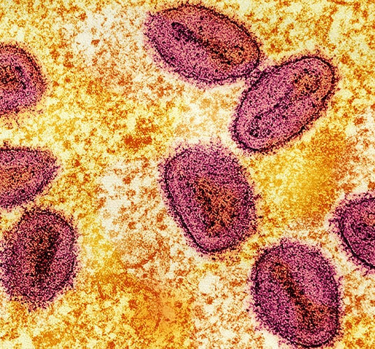 What you need to know about monkeypox